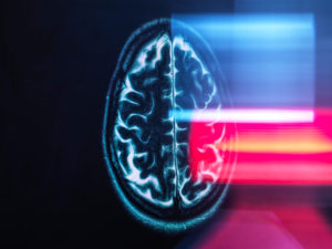 Refection of MRI brain scan on monitor display Refection of MRI brain scan on monitor display