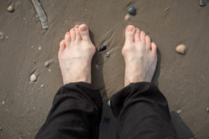 Füße mit Hallux Valgus im Sand Füße mit Hallux Valgus im Sand