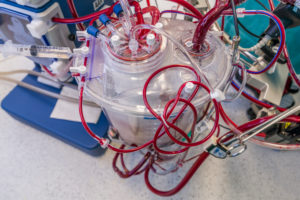 Heart Lung machine-Heart valve replacement surgery, operating room,
