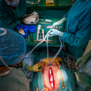 Heart valve replacement surgery, operating room,