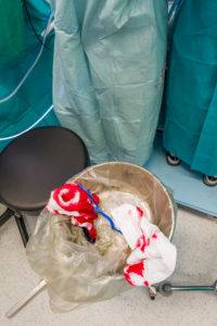 Bloody surgical sponges-Heart valve replacement surgery, operating room,