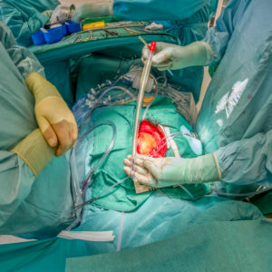 Heart valve replacement surgery, operating room,
