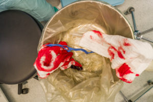 Bloody surgical sponges-Heart valve replacement surgery, operating room,