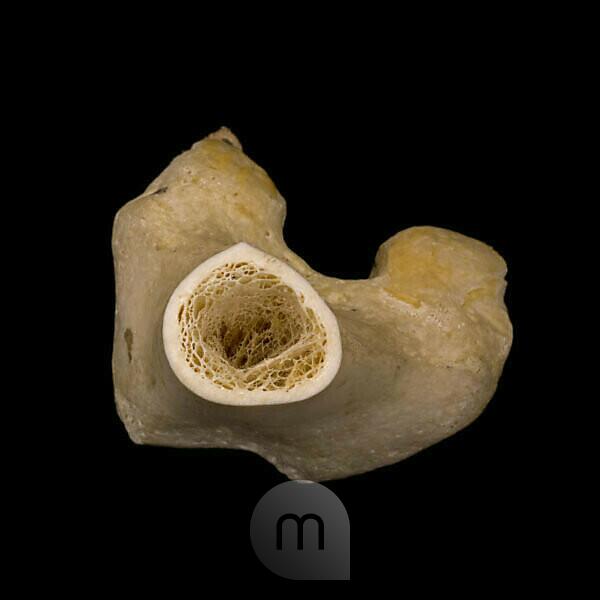 Bildagentur Mauritius Images Human Leg Bone Cross Section The Trabeculae Visible Inside Form The Internal Supportive Structure Of Long Bones