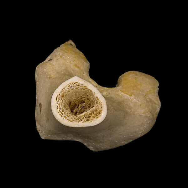 Bildagentur Mauritius Images Human Leg Bone Cross Section The Trabeculae Visible Inside Form The Internal Supportive Structure Of Long Bones