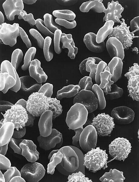 white blood cells under electron microscope