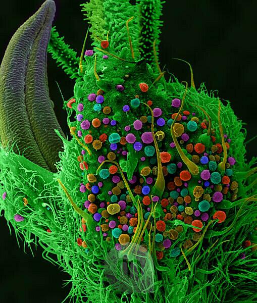 Microscopic photograph of C. sativa leaf-trichomes; CST