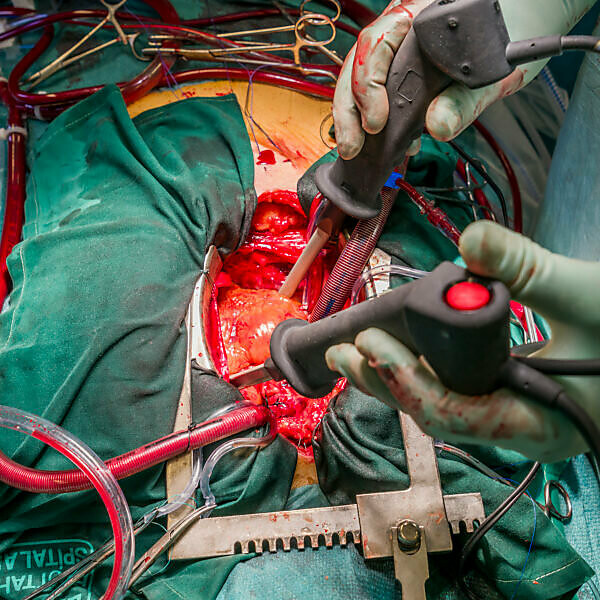 Heart valve replacement surgery, operating room,