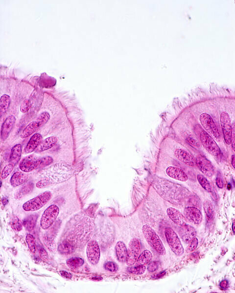 Bildagentur Mauritius Images Ciliated Pseudostratified Columnar Epithelium Of A Bronchus Respiratory Epithelium Cilia Basal Bodies And Goblet Cells Are Clearly Show Light Microscope Micrograph H E Stain 100x At 10 Mm