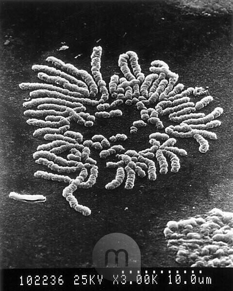 electron microscope images of chromosomes