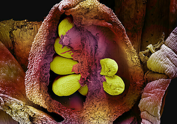 Bildagentur Mauritius Images Scanning Electron Micrograph Of Ovule With Embryo Sac In Seed Plants The Ovule Small Egg Is The Structure That Gives Rise To And Contains The Female Reproductive