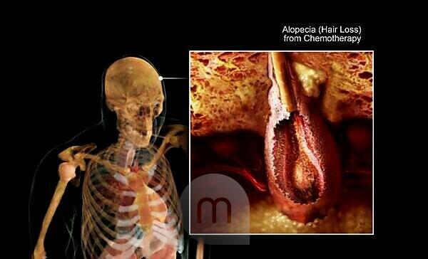 Cross-section anatomy of female chest and abdomen muscles - SuperStock